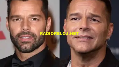 Photo of El rostro de Ricky Martin: La verdad detrás de los supuestos arreglos estéticos